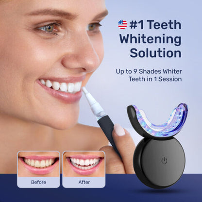 Teeth Whitening Kit