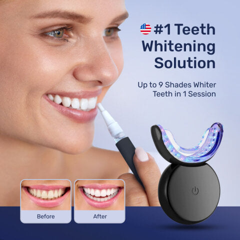 Teeth Whitening Kit