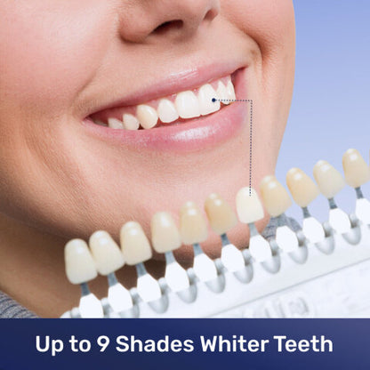 Teeth Whitening Kit