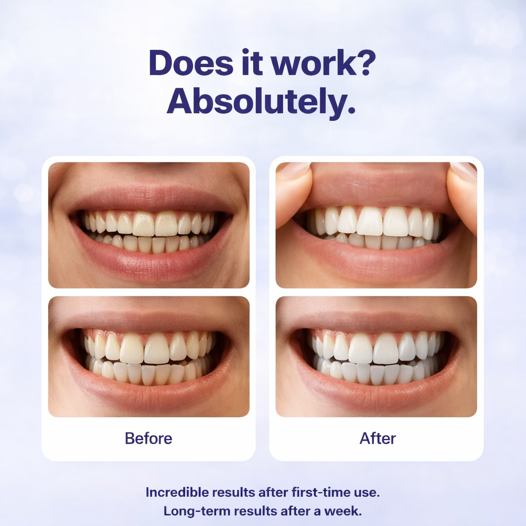 Dentimi Purple Teeth Whitening Strips