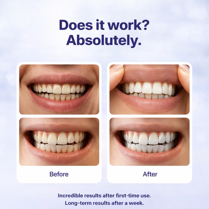 Dentimi Purple Teeth Whitening Strips